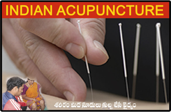 Acupuncture Therapy
